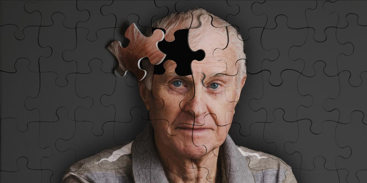 Científicos descubren nuevo método para combatir Alzheimer