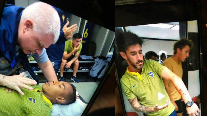 Jugadores de Boca afectados por los incidentes antes de la Superfinal