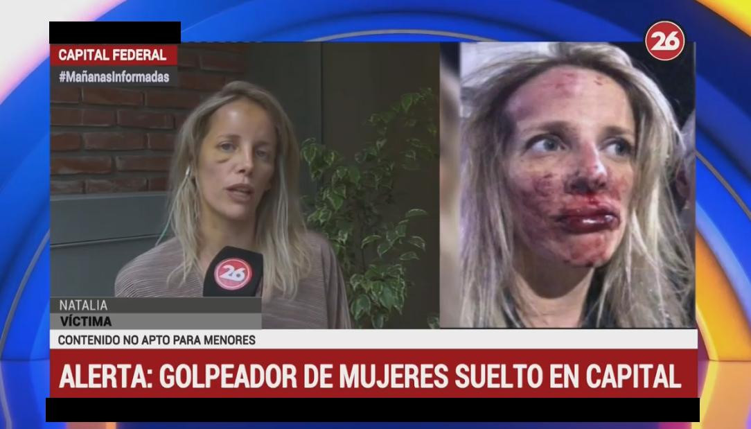 Mujer golpeada en Caballito - Canal 26