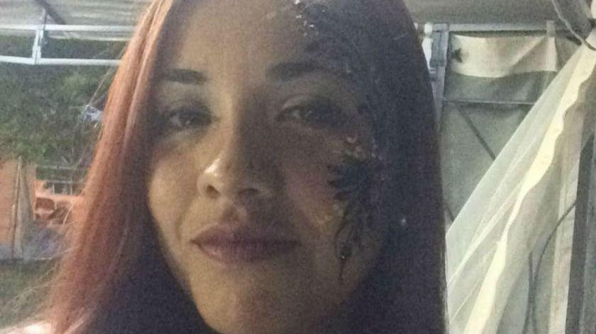 Johana Villafañe, argentina atacada por sus pitbull en Estados Unidos