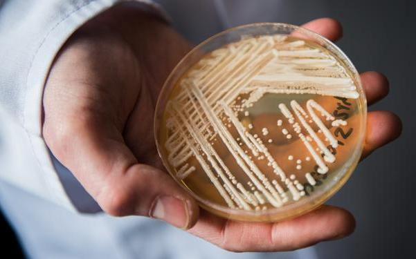 ¿Cuáles son las superbacterias más resistentes? Candida auris 