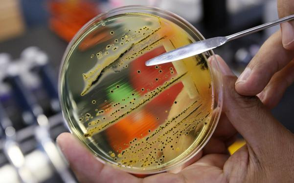 ¿Cuáles son las superbacterias más resistentes? Salmonela 