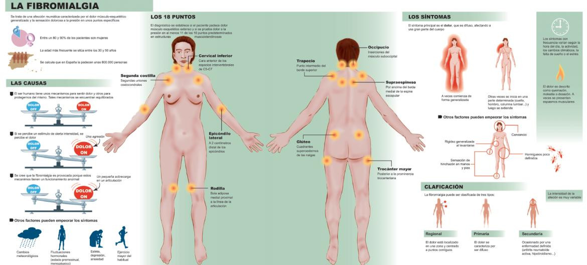 Fibromialgia - salud