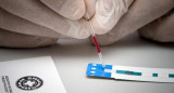 VIH Sida, salud, medicina, enfermedades