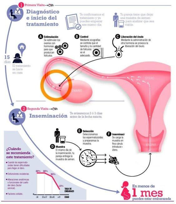 Fertilidad, tratamiento para ser padres, salud, NA