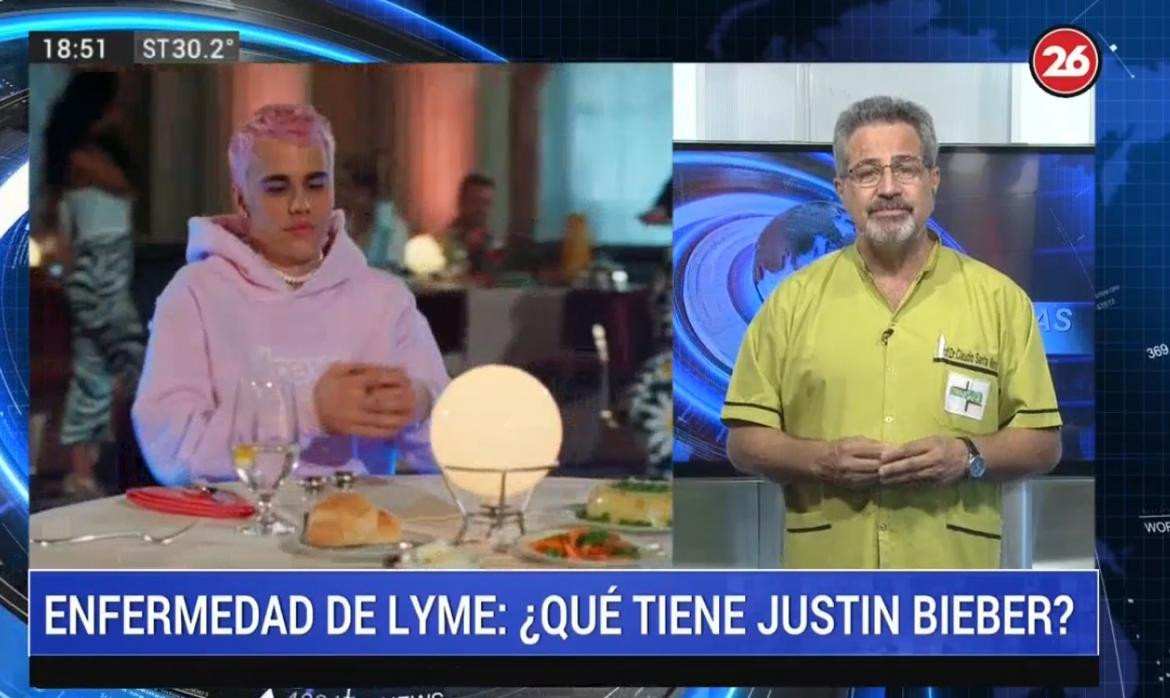 Doctor Claudio Santa María sobre enfermedad de Lyme, que padece Justin Bieber