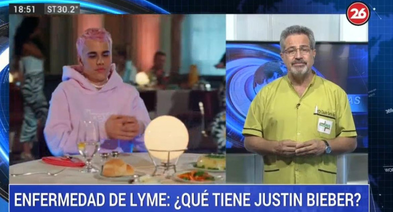 Doctor Claudio Santa María sobre enfermedad de Lyme, que padece Justin Bieber