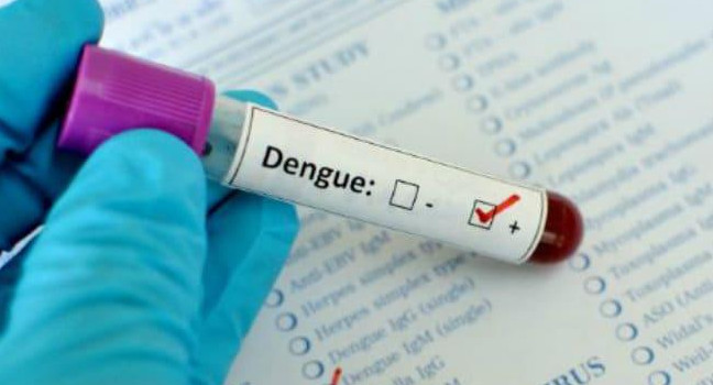 Dengue, análisis en laboratorio, estudios