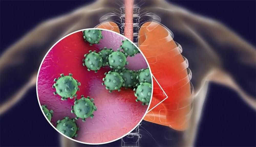 Coronavirus, análisis en laboratorio