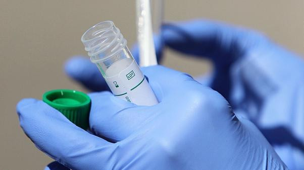 Francia desarrolla un test rápido para el coronavirus