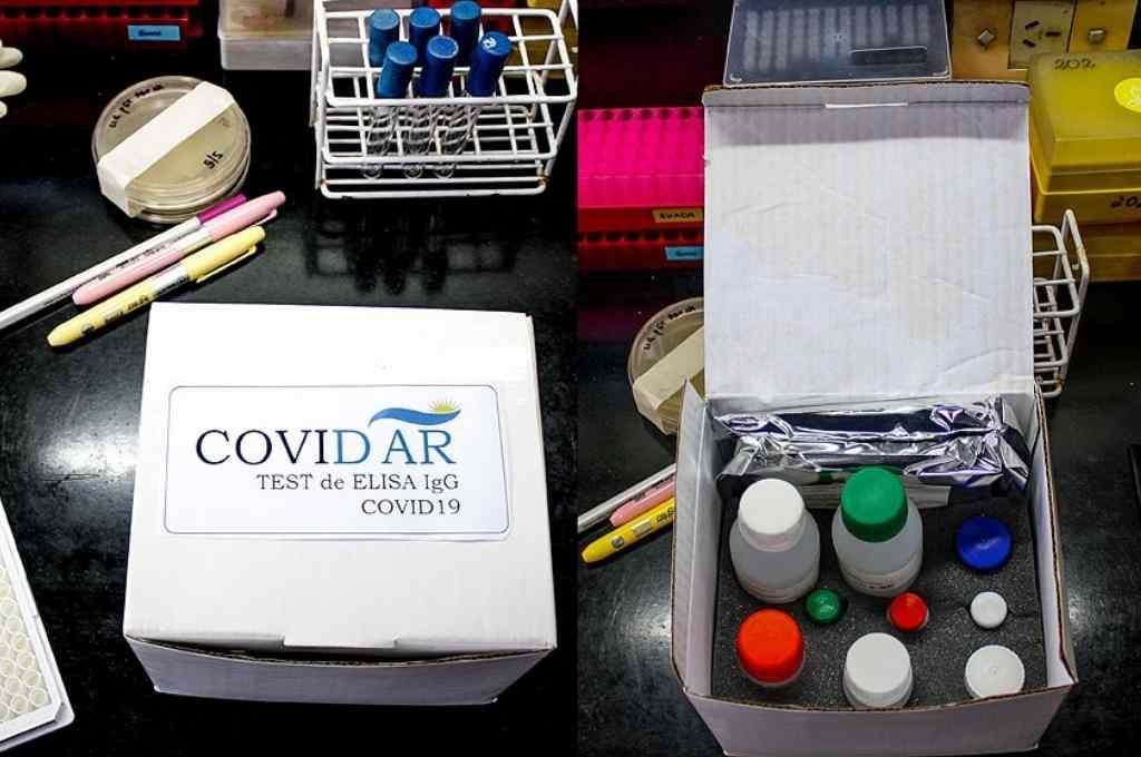 Test contra el coronavirus fabricados en Argentina