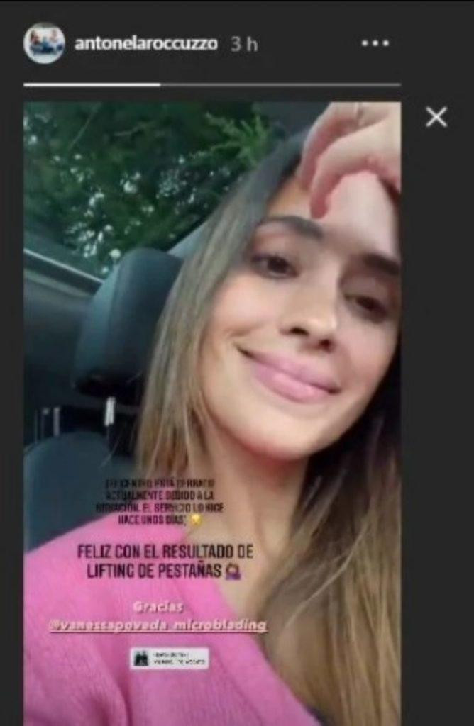 Antonela Roccuzzo sorprendió con un retoque estético que se realizó