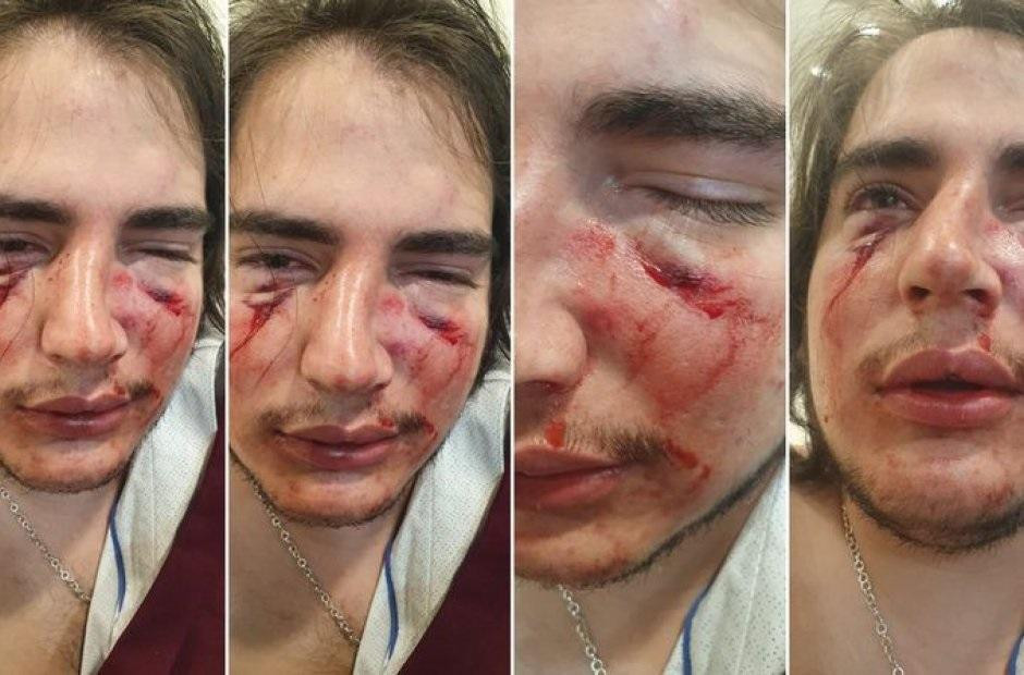 Ataque de rugbiers a un joven en Córdoba