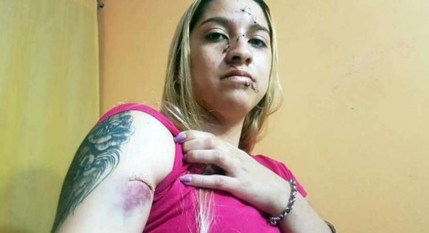 Melisa, joven agredida en Córdoba