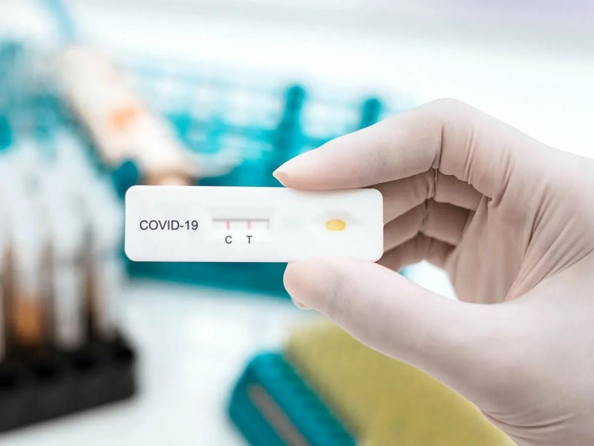 Test rápido de Coronavirus