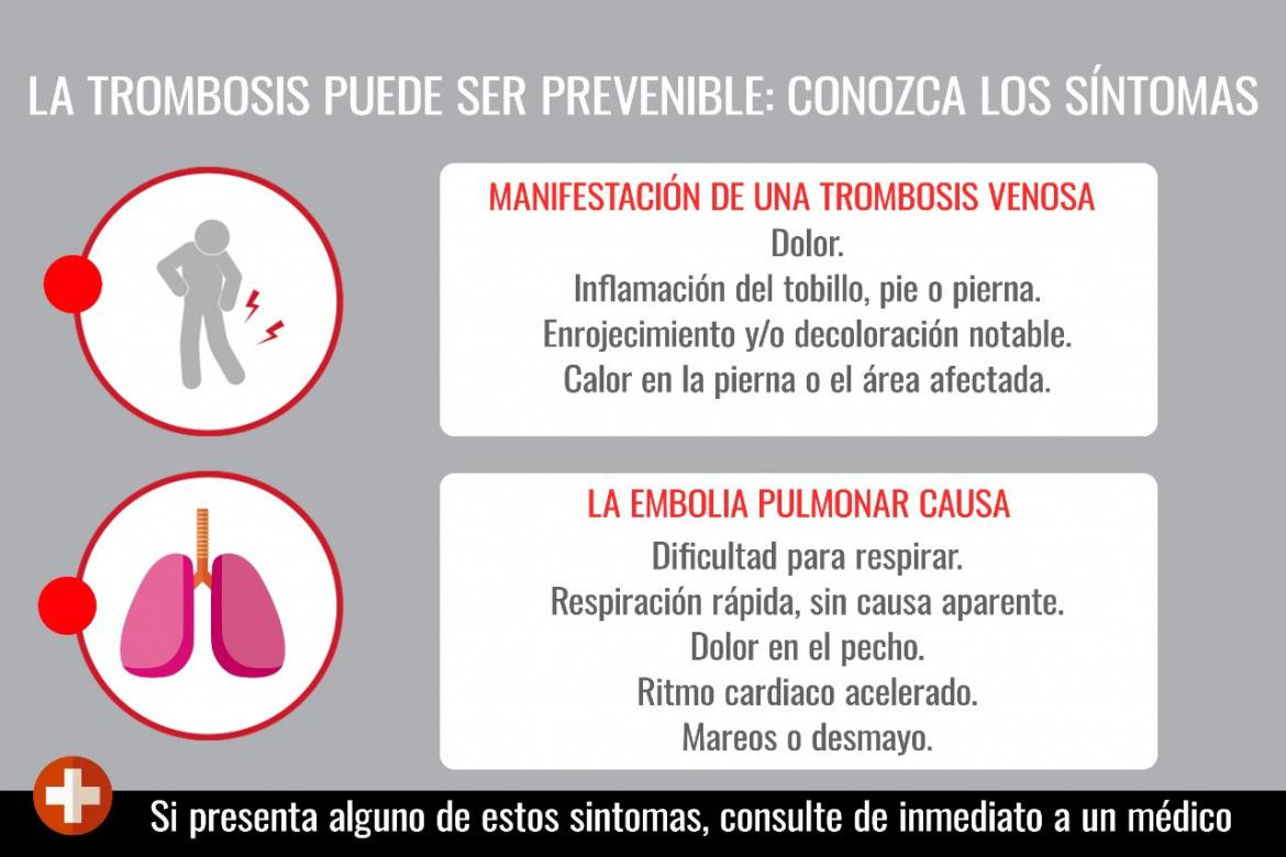 La trombosis puede ser prevenible: sintomas