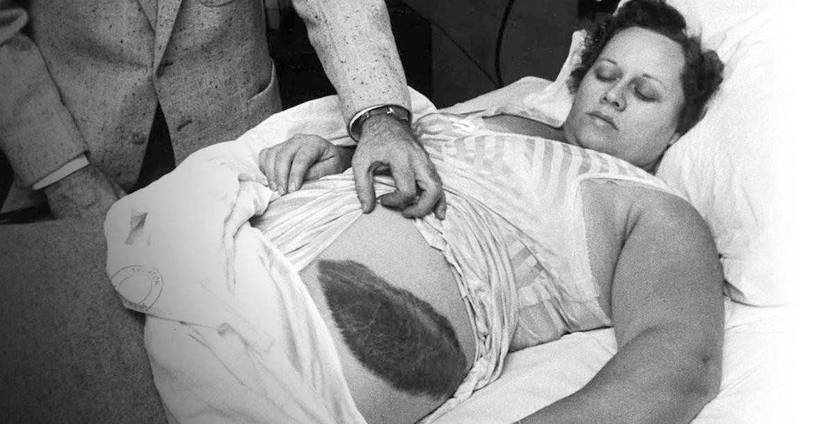 Ann Hodges, la mujer que sobrevivió tras ser golpeada por un meteorito