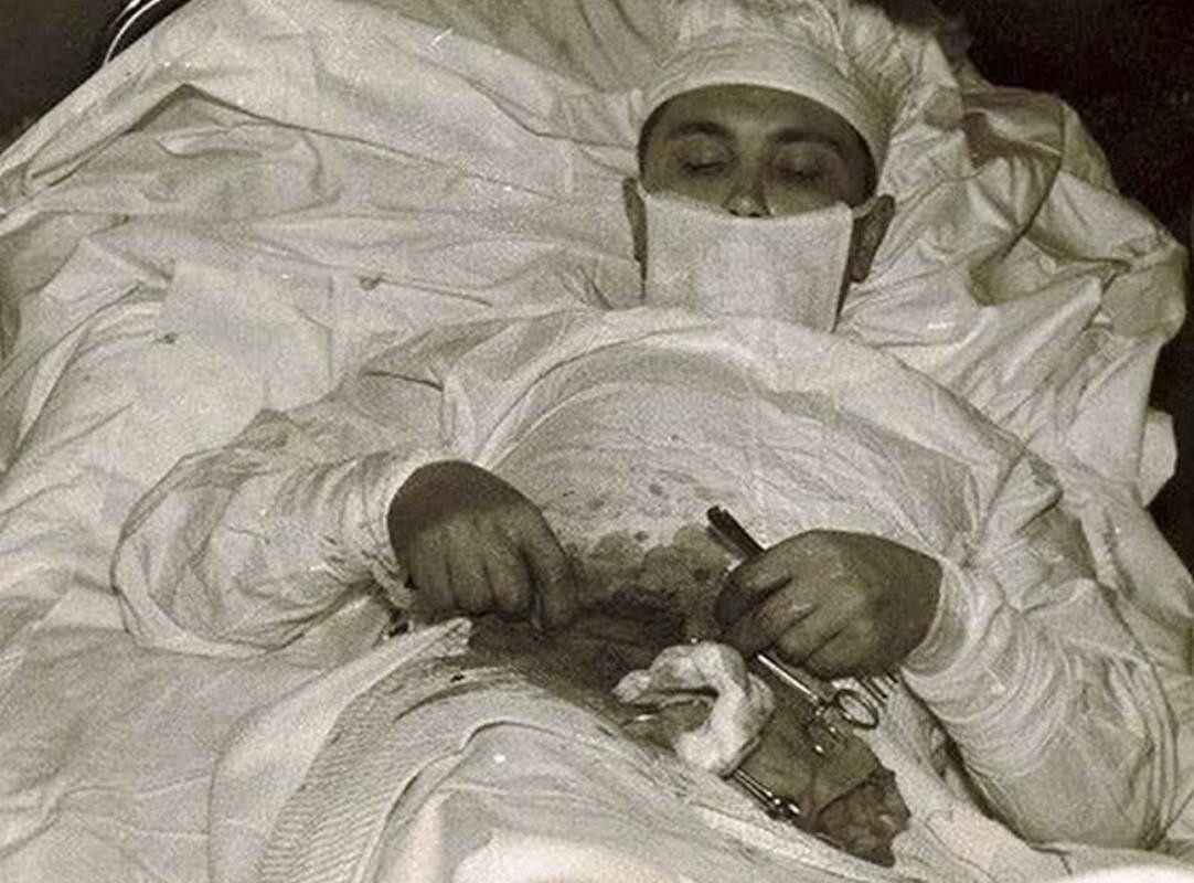 Leonid Rógozov, el médico cirujano que se operó a sí mismo	