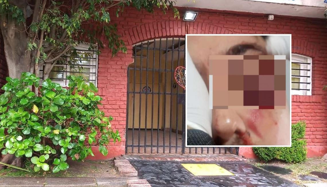 Habló la mujer del hombre golpeado tras una discusión en un 