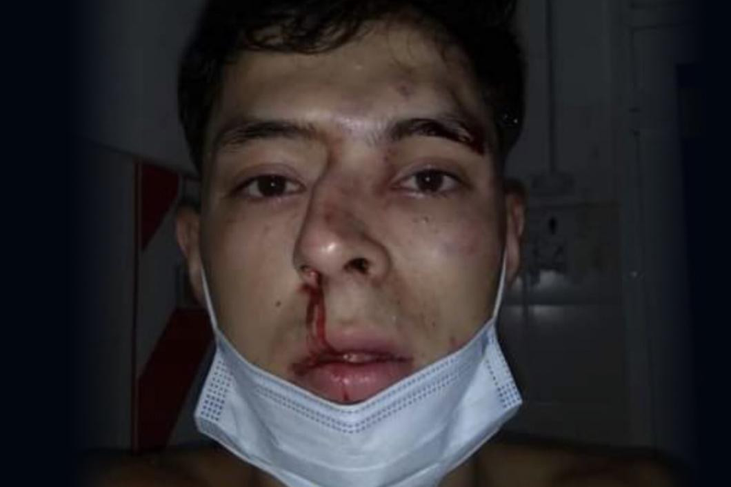 Estudiante de periodismo atacado en Chaco, NA, Twitter