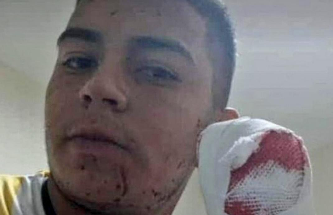 Joven atacado con un machete en Tucumán