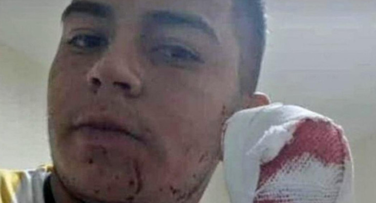 Joven atacado con un machete en Tucumán