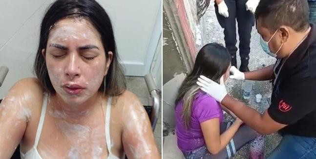 Ataque a joven en Tucumán