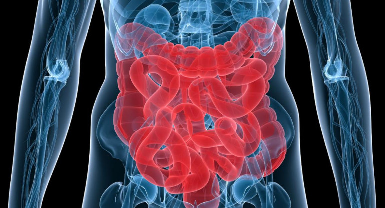 Cáncer de colon, foto IBBiotech