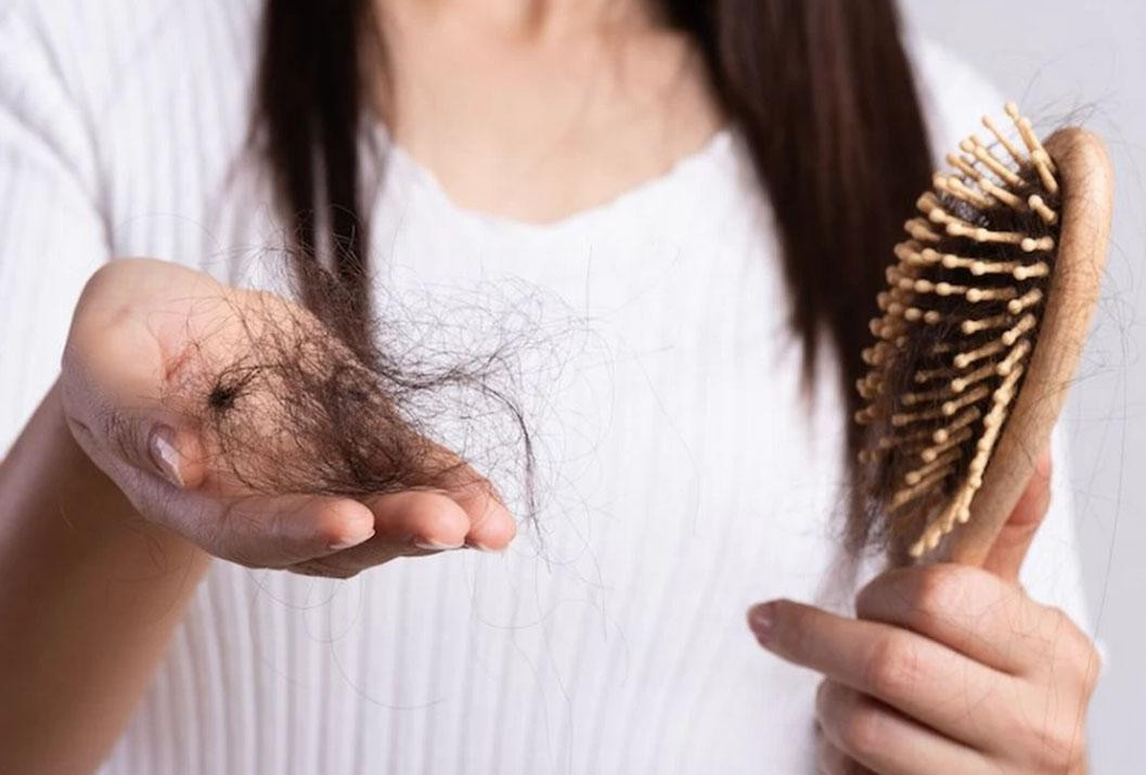 Pelo, caída del pelo, caída del cabello, NA