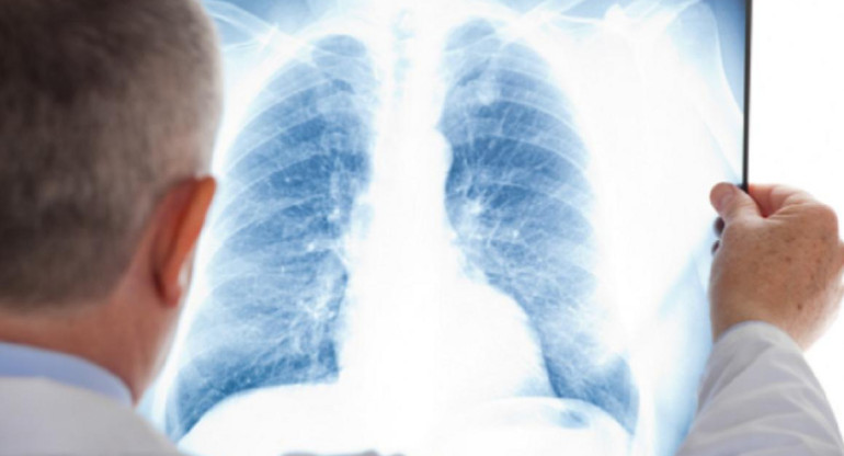 Nueva droga para un subtipo de cáncer de pulmón