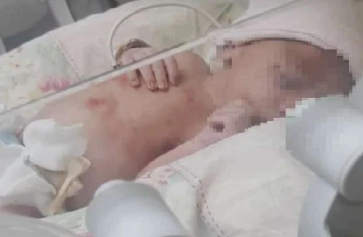 El bebé se encuentra internado en buen estado de salud, foto gentileza Misiones Online