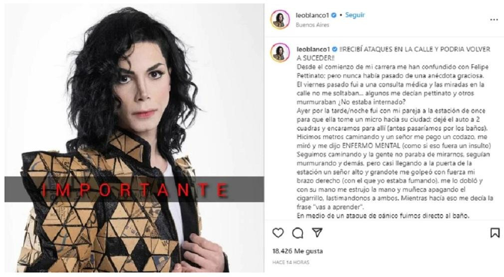 Leo Blanco, imitador de Michael Jackson, NA, IG