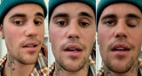 Justin Bieber fue diagnosticado con un raro trastorno