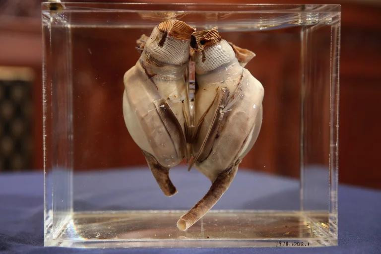 Primer corazón artificial implantado a un humano. Foto: Getty Images