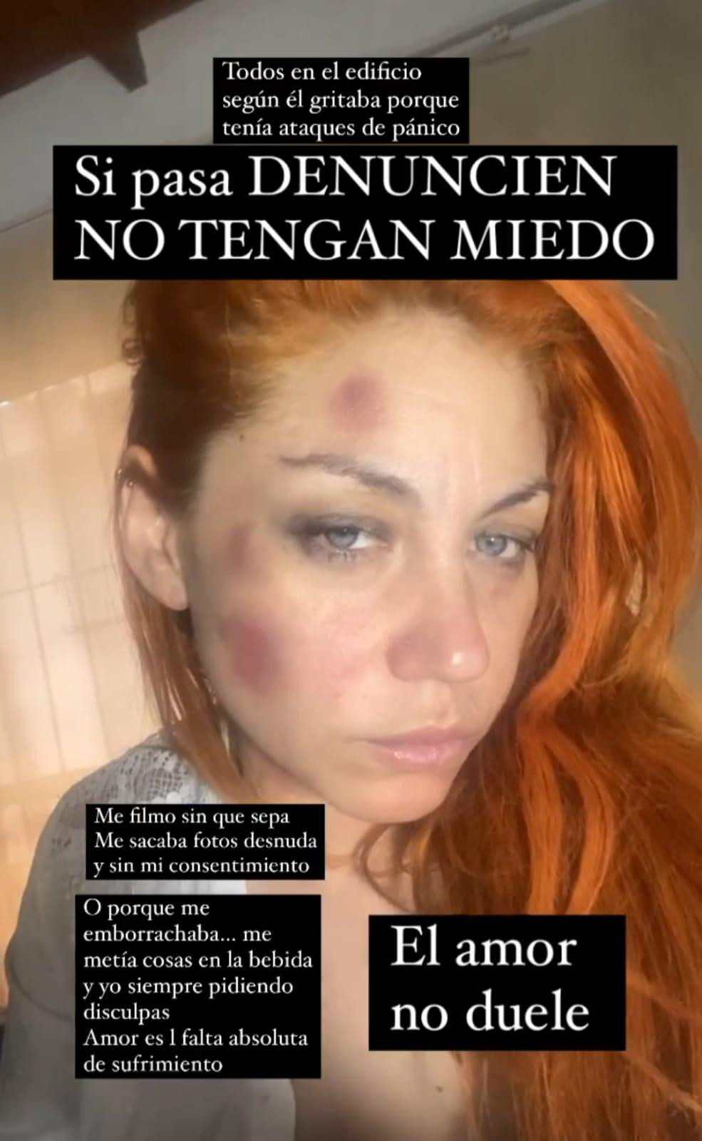 Lourdes de Bandana denunció un ataque de violencia de género. Foto: Instagram.	