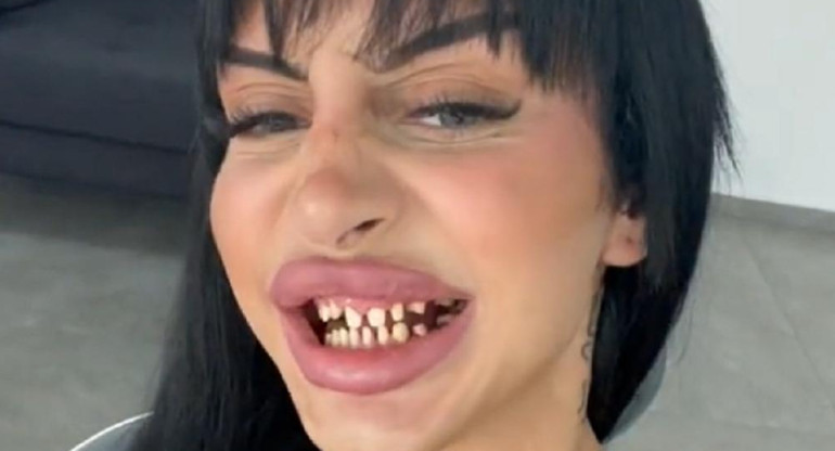Se arregló los dientes. Foto: captura.