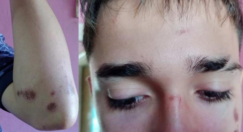 Así quedó el joven atacado a la salida de un boliche en Cañuelas. Foto: NA