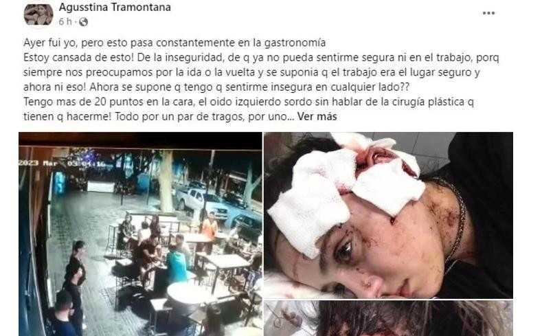 Posteo de la mosa agredida en Mendoza. Foto: Facebook