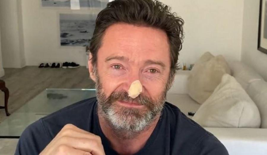 Hugh Jackman mostró su estado en redes sociales.