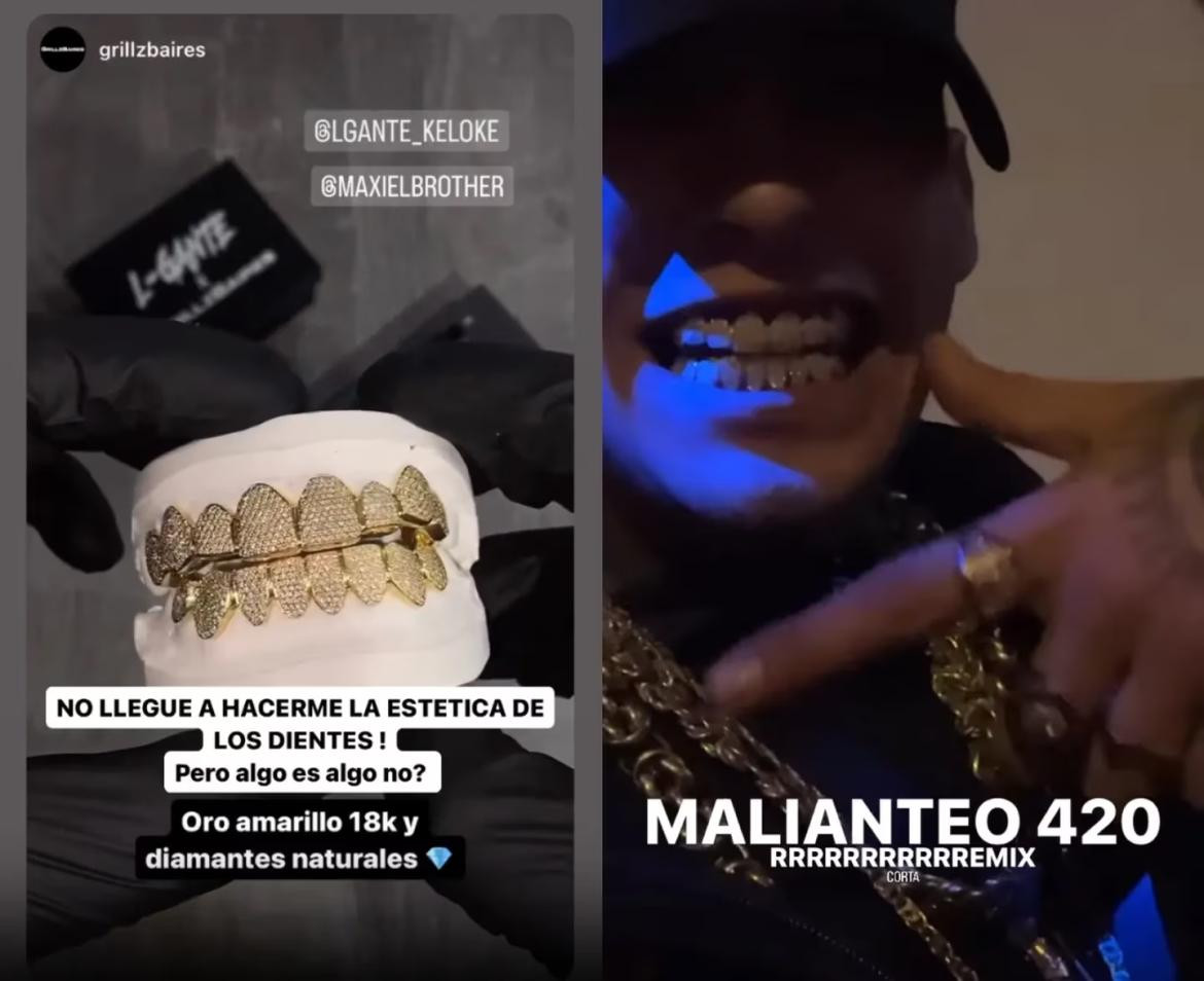 Los nuevos dientes de L-Gante. Foto: Instagram.