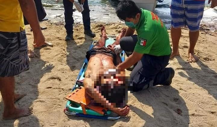 Tres argentinos fueron brutalmente atacados en México. Foto: Twitter: @azucenau.