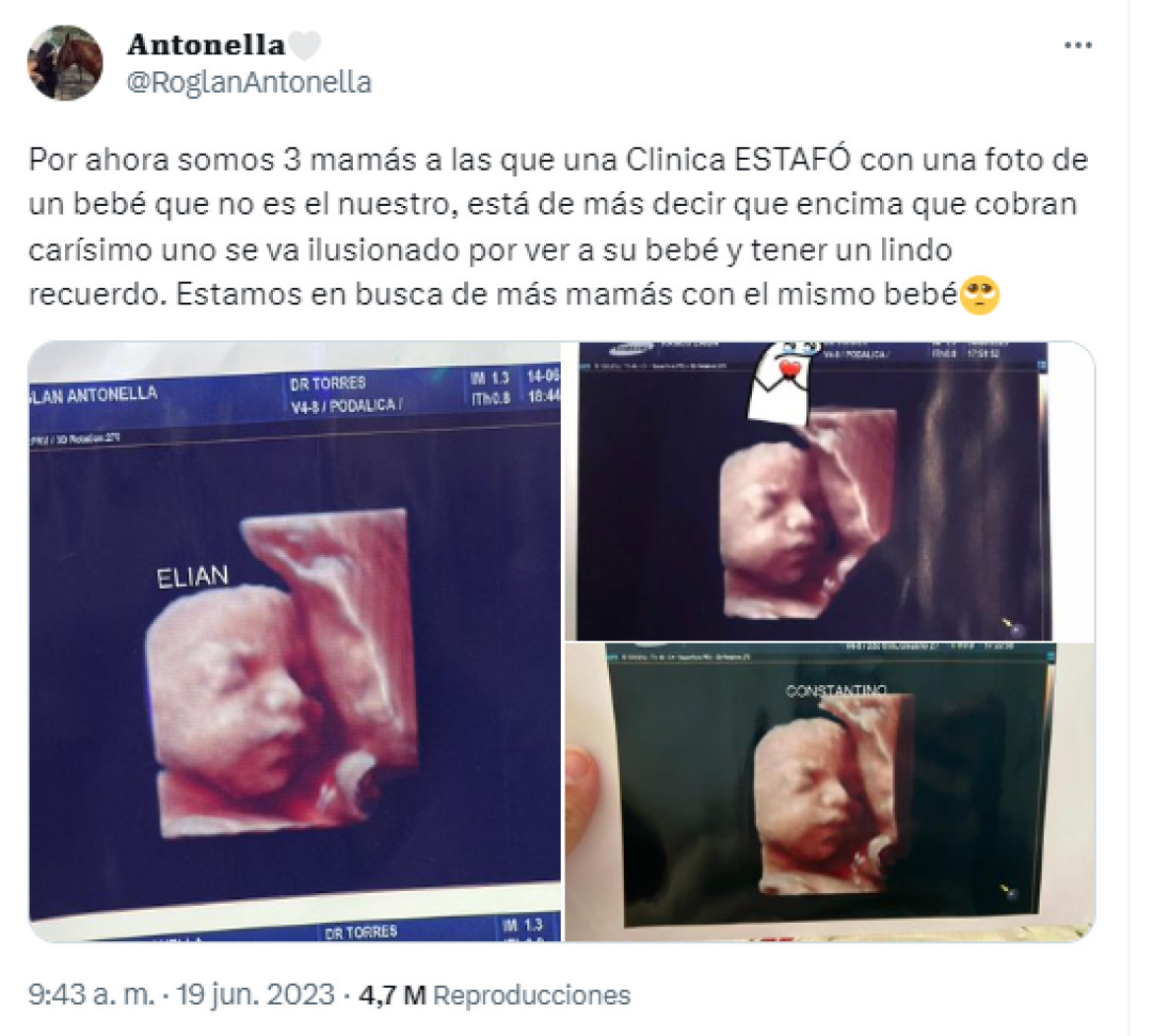 Denuncian a una clínica por entregar la misma foto de la ecografía 5D a todas las pacientes. Foto: Twitter.