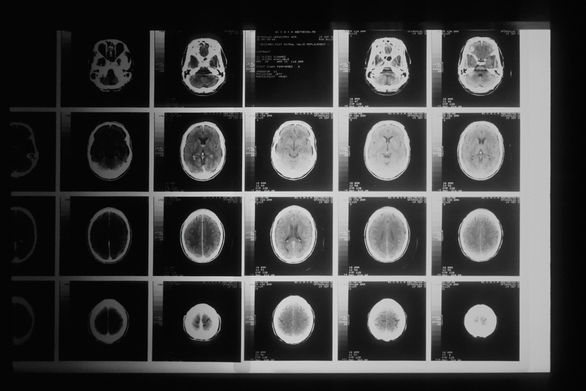 El funcionamiento del cerebro humano continúa siendo un misterio para los médicos e investigadores. Foto: Unsplash.