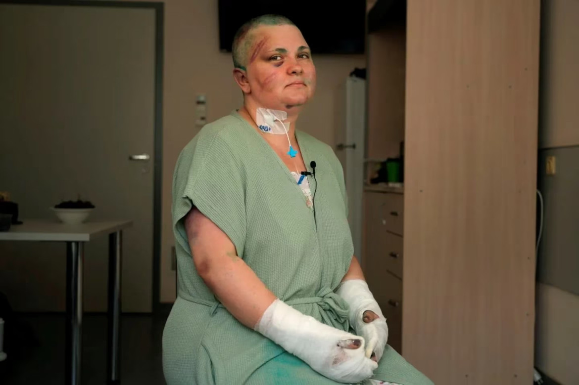 Elena Milashina, desde el hospital en Moscú. Foto: AP.
