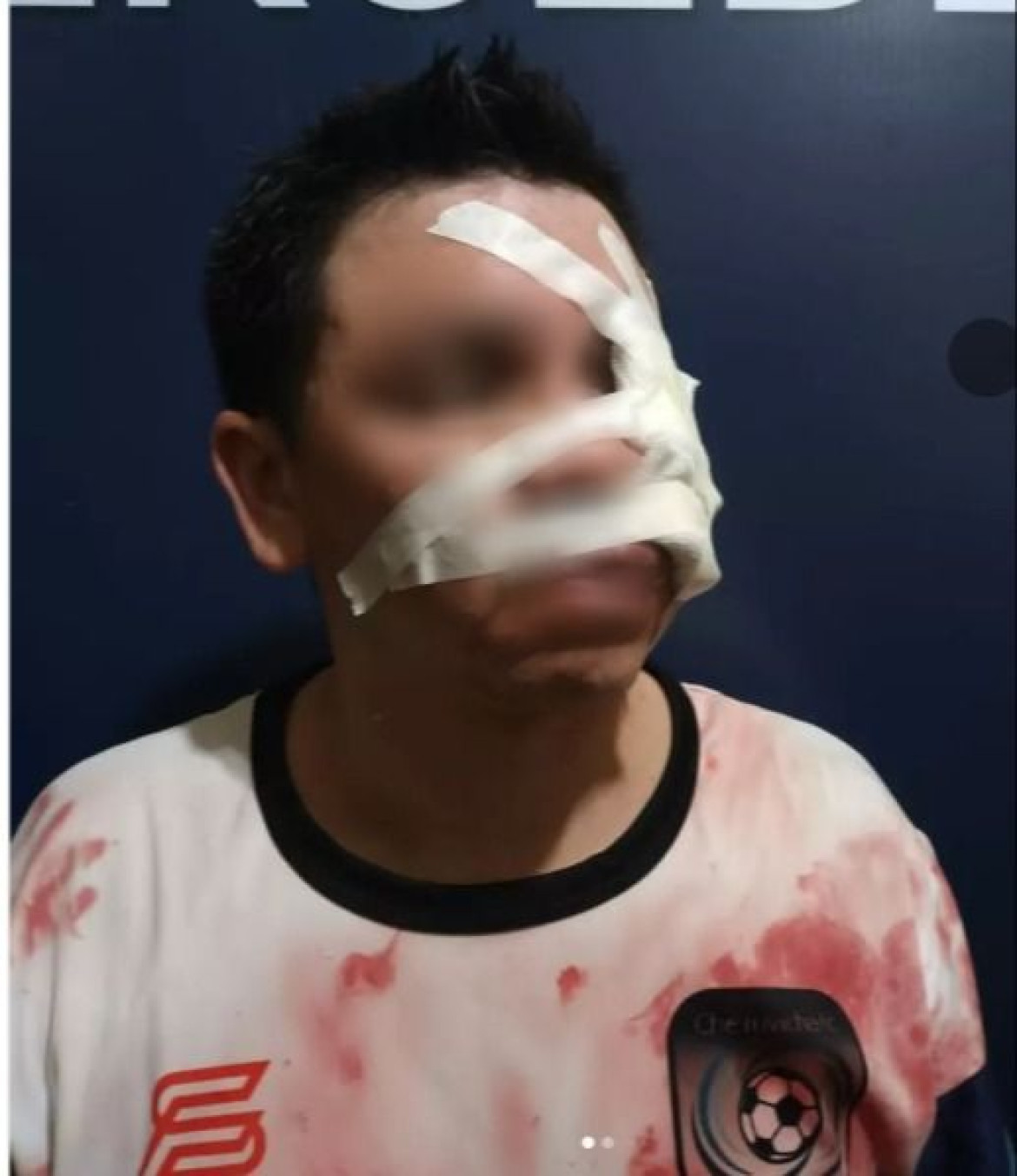 Jugador agredido en un partido de fútbol amateur en Corrientes.