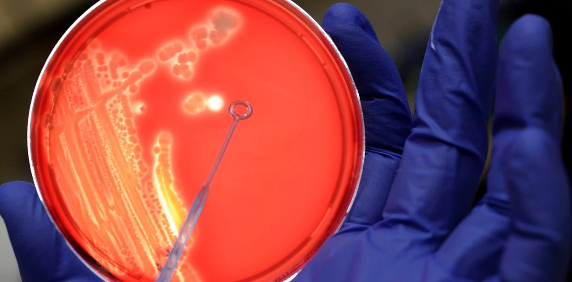 Bacterias en análisis de la Escherichia coli. Foto: EFE