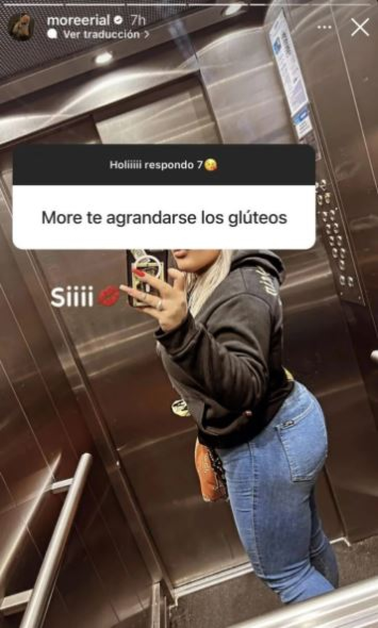 La historia que compartió More Rial para mostrar su operación de glúteos. Foto: Instagram.