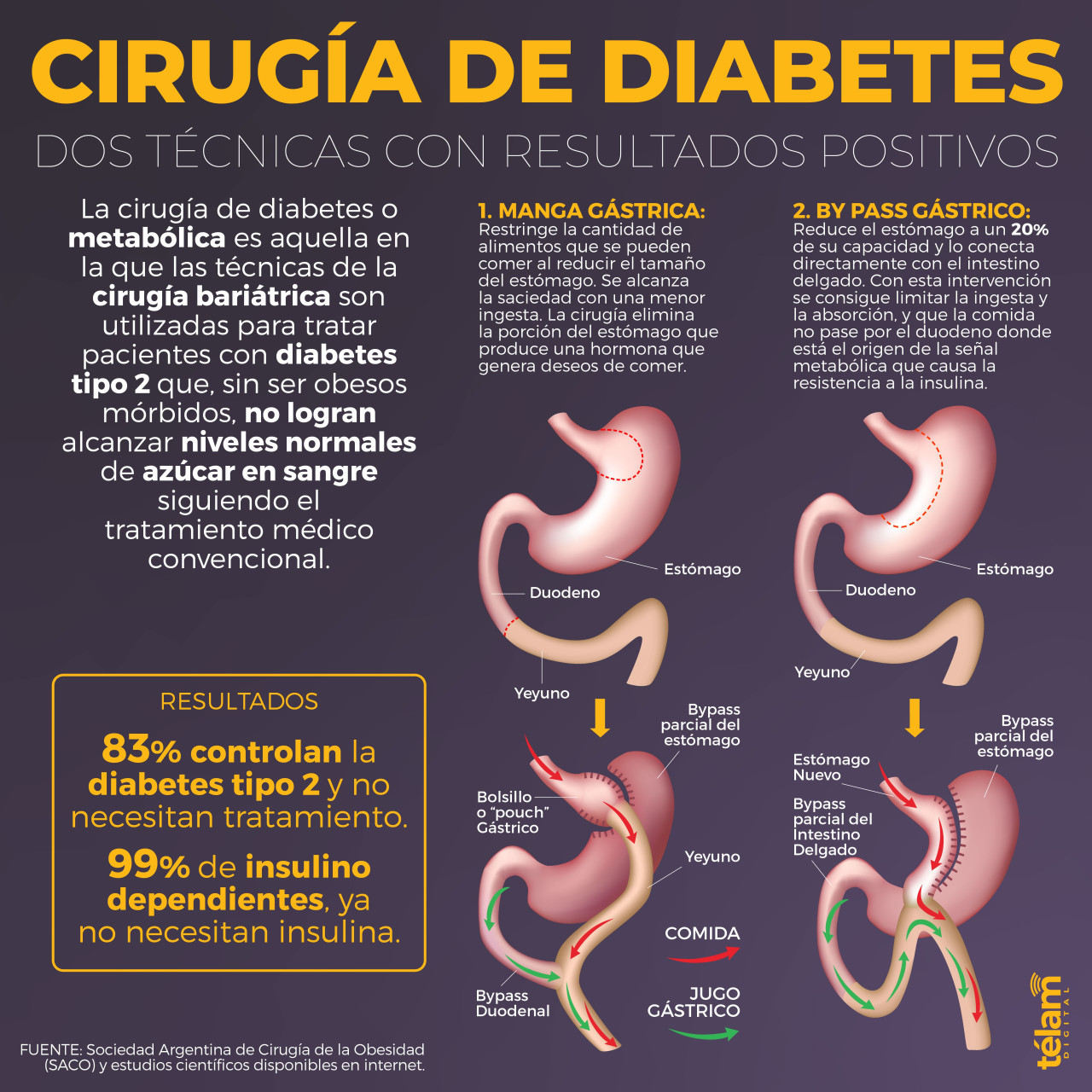 Cirugía de diabetes. Foto: Télam.