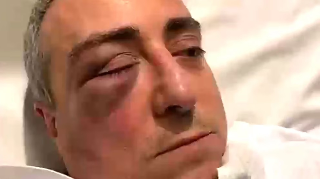 Así quedó el rostro de la víctima. Foto: captura de video.