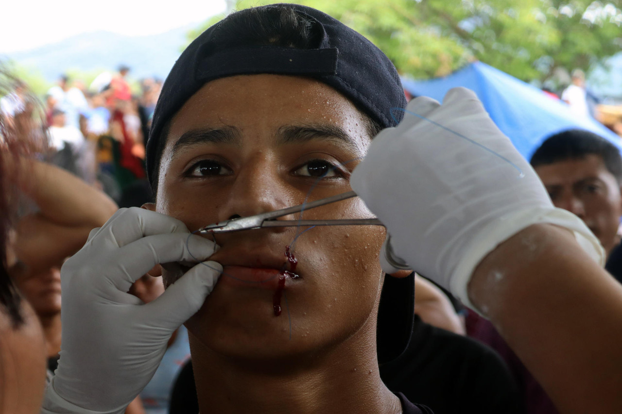 Un voluntario que cosió los labios en forma de reclamo. Foto: EFE.